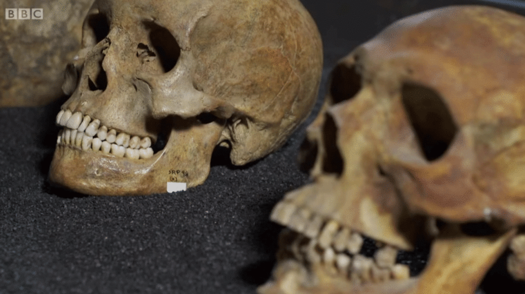 medieval-skull-then-with-sugar